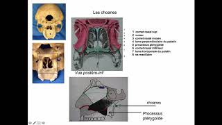 Cavités nasales  limites osseuses et pyramide nasale sinus aériques [upl. by Vanya]