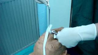 Anterior nasal packing ENT PMK [upl. by Aivatahs]