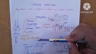 Cheese Reaction Unveiled Tyramine and MAO Inhibitors Explained [upl. by Beitch]