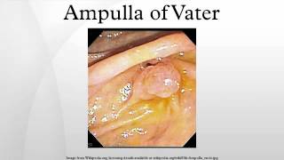 Ampulla of Vater [upl. by Llerrat304]