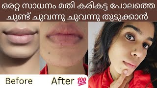 സത്യത്തിൽ 10000 result തരുന്ന permanent pink lips കിട്ടാൻകിട്ടിയ നിറം ഒരിക്കലും പോവില്ല😲 [upl. by Celinda]