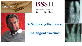 Phalangeal fractures by Dr Wolfgang Hintringer [upl. by Garvey]