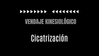 Vendaje Kinesiológico para cicatrización [upl. by Quenby]