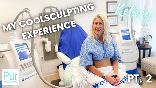 MY COOLSCULPTING EXPERIENCE PT 2  Flanks Treatment  Pūr Skin Clinic [upl. by Tomas404]