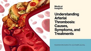 Arterial Thrombosis [upl. by Amethist]