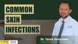 COMMON SKIN INFECTIONS [upl. by Leirraj]