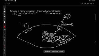 Tetany Mechanism  Hypocalcemia  Ayman Akif [upl. by Scheider815]