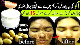 Natural remedies for pigmentation on face [upl. by Pacian]