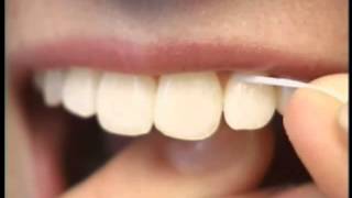 How to Properly Floss Your Teeth by Hermosa Beach Dentist Dr Mondavi [upl. by Atima]