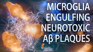 Microglial engulfment of Aβ plaques  Alzheimer’s disease  medical animation [upl. by Elatnahc]