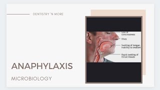 ANAPHYLAXIS amp ITS MANAGEMENT [upl. by Voe]