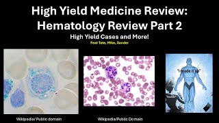 High Yield Medicine Review Hematology Part 2 High Yield Cases for USMLE and NBME Exams [upl. by Wagner]