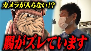 「お腹を開きますか？」エコー検査で発覚した歪み｜疑いがかけられた病とは！？ [upl. by Won]