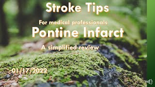 Stroke Tips Pontine infarct a simplified review [upl. by Jermain]