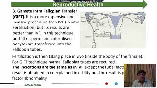 Assisted Reproductive Technologies ART [upl. by Isis]