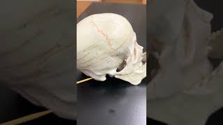 Bones  Cranial Sutures [upl. by Naed811]