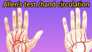 Allen test  modified Allens test  Allens test procedure for hand circulation [upl. by Kela]