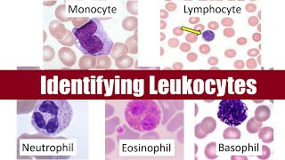 Identifying Leukocytes [upl. by Marino941]