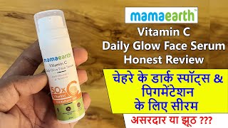 Mamaearth Daily glow Vitamin C Face Serum Review  2 month Result about Pigmentation [upl. by Ansela]