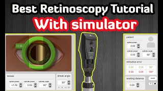 Retinoscopy Simulator  Practice Online  Tutorial [upl. by Tarrel721]