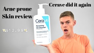 Cerave SA cleanser Review On Oily Skin [upl. by Naujahs]