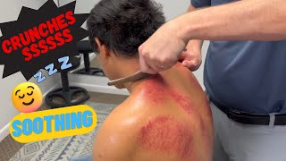 ULTIMATE RELAXATION💆🏼‍♂️with Chiropractic Scraping treatment [upl. by Peedsaj]