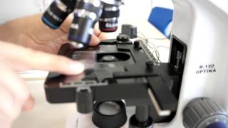 ALevel Biology Calibration of Eyepiece Graticule with stage micrometer [upl. by Fisoi]