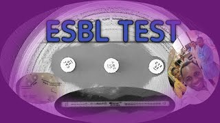 ESBL LABORATORY TESTS SWAHILI SBK [upl. by Amoritta]