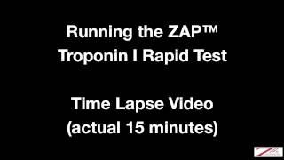 ZBx Cardiac Troponin I Rapid Test [upl. by Genovera210]