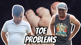 DEVINS TOE PROBLEMS [upl. by Trina]