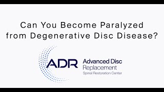 Can You Become Paralyzed from Degenerative Disc Disease [upl. by Hsaniva260]