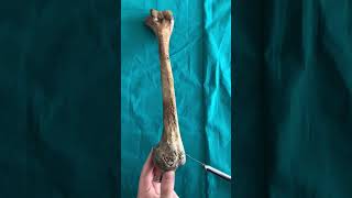 Humerus Üst ekstremite Kemikleri Anatomi İnsan Anatomisi TUS DUS SBF Soru çözümü Arasınav [upl. by Ettenahs923]