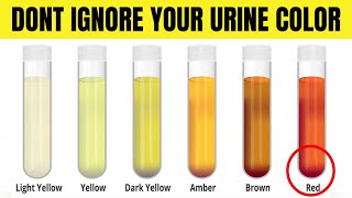 What Your Urine Color Says About Your Health  Healthy Urine Color [upl. by Brittani]