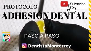 ✅ PROTOCOLO de Adhesión 👅 PASO a PASO [upl. by Cavanaugh]