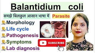 Balantidium coli in Hindi  Parasite  Morphology  Life Cycle  Symptoms  Hindi  Parasitology [upl. by Miehar]