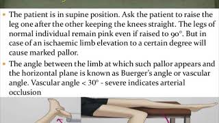 Buerger’s postural test for lower limb ischemia [upl. by Ramos147]