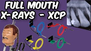 Full Mouth XRays  XCP Tips and Tricks [upl. by Egedan]