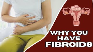 Uterine Fibroids  Causes  Symptoms  Diagnosis  Treatments [upl. by Terryn]