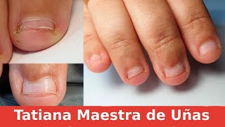 Uñas MORDIDAS😬 Increíble transformación  UÑAS COMIDAS [upl. by Atnuhs947]