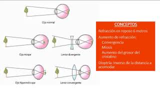 EUNACOM UPV  Oftalmología [upl. by Ahseekat773]