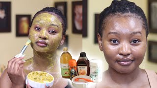 DIY TURMERIC AND BENTONITE CLAY MASK  Pimple and Dark Spots Treatment  Tsholo Phoka [upl. by Llenreb]