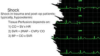 Shock in Trauma [upl. by Lockhart]