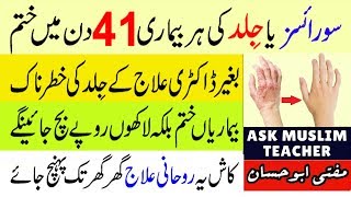 Psoriasis Ka Rohani ilaj  Wazifa for Skin Disease  Chambal Ka Rohani ilaj  Jild ki Bimari ka ilaj [upl. by Cheng772]