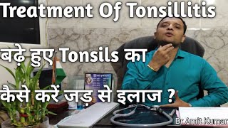 Treatment Of Tonsillitis  बढ़े हुए Tonsils का कैसे करें जड़ से इलाज Tonsils का इलाज। [upl. by Ettelohcin798]