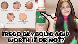 Can Trego Glycolic Acid Clear All Your Skin Problems Review Inside glycolicacidforskinlightening [upl. by Roosevelt]