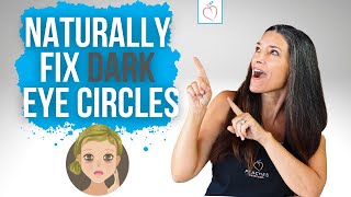 How to Naturally Remove and Prevent Dark Circles amp Puffy Eyes [upl. by Richmound]