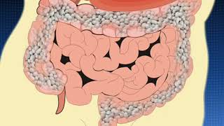 Салофальк  лекарственные формы болезнь Крона ВЗК © Salofalk  dosage forms Crohns disease IBD [upl. by Press610]