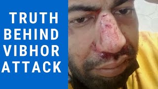 Truth Behind Vibhor Anand Attack  What Does it Have to Do with Sushant Singh Rajput Case [upl. by Enutrof443]