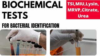 Biochemical Tests for Bacterial Identification Part1TSI MIU MRVP Lysin Urea Citrate [upl. by Rolyt]