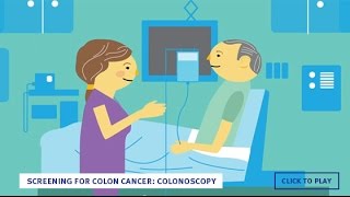 Screening for Colon Cancer Colonoscopy English [upl. by Aisha]